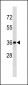 BLVRA Antibody (Center Y83)