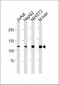 NR3C1 Antibody