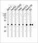 Erk2 Monoclonal Antibody [Knockout Validated]