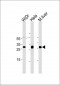 CDX1 Antibody (C-term)