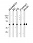 Creatine Kinase BB Antibody  (Center)