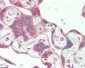 MORC3 Antibody (Center)