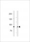 SEMA6B Antibody (C-term)