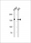 DHX9 Antibody (N-term)