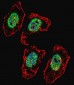 HBO1/MYST2 Antibody (Center)