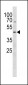 PSMC2 Antibody (N-term)