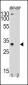 TSPY Antibody (C-term)