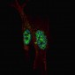 STAT3 Antibody (C-term S727)