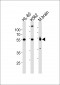 PTGER4 Antibody (Center)