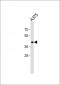 SIRPB1 Antibody (N-term)