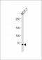 TSPYL2 Antibody (Center)