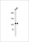 UBE3C Antibody (Center)