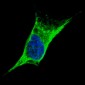 Vimentin Antibody (C-term)