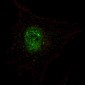 AP3669a-Phospho-PDX1T11-Antibody