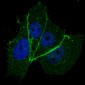 Phospho-ERBB2(T1172) Antibody