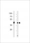 DANRE hoxa1a Antibody (Center)