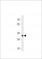 DANRE hoxb8b Antibody (C-term)
