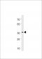 DANRE hoxc13a Antibody (C-term)