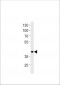 DANRE hoxd11a Antibody (Center)