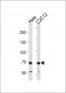 SDHA Antibody (C-term)