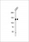 ECE2 Antibody (Center)