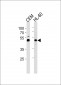 BLMH Antibody (Center)