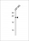 CNTF Antibody (Center)