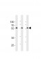 TRIM6  Antibody (N-term)