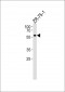 PPP2R2A Antibody (N-term)