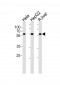 POLD2 Antibody (Center)