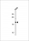 NDUFB10 Antibody (Center)