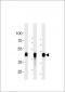 CYK18 Antibody (C-term)