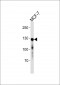 CDH1 Antibody(Ascites)