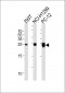 UCHL1 Antibody (C-term)