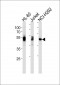 LCK Antibody(Ascites)