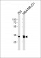 GOLPH3 Antibody (C-term)
