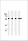 TPIPb Antibody (C-term)(Ascites)