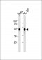 VRK1 Antibody (Center)(Ascites)
