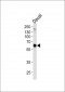 USP22 Antibody (C-term)