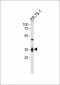 IL3RA Antibody (C-term)