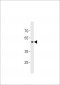 GPR150 Antibody (C-term)