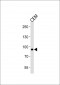 MATN2 Antibody (C-term)