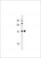 AP20483a-SSNA1-Antibody-N-term
