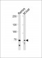 TICAM1 Antibody (N-term)