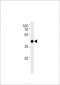 AP20493b-Mouse-Tcfap2d-Antibody-C-term