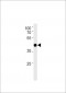M Tcfap2d Antibody (C-term)