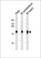 NDUFS7 Antibody (Center)