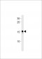 Zebrafish ndufaf3 Antibody (N-term)