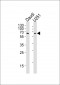 YY1 Antibody