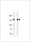 VEGFR3 Antibody